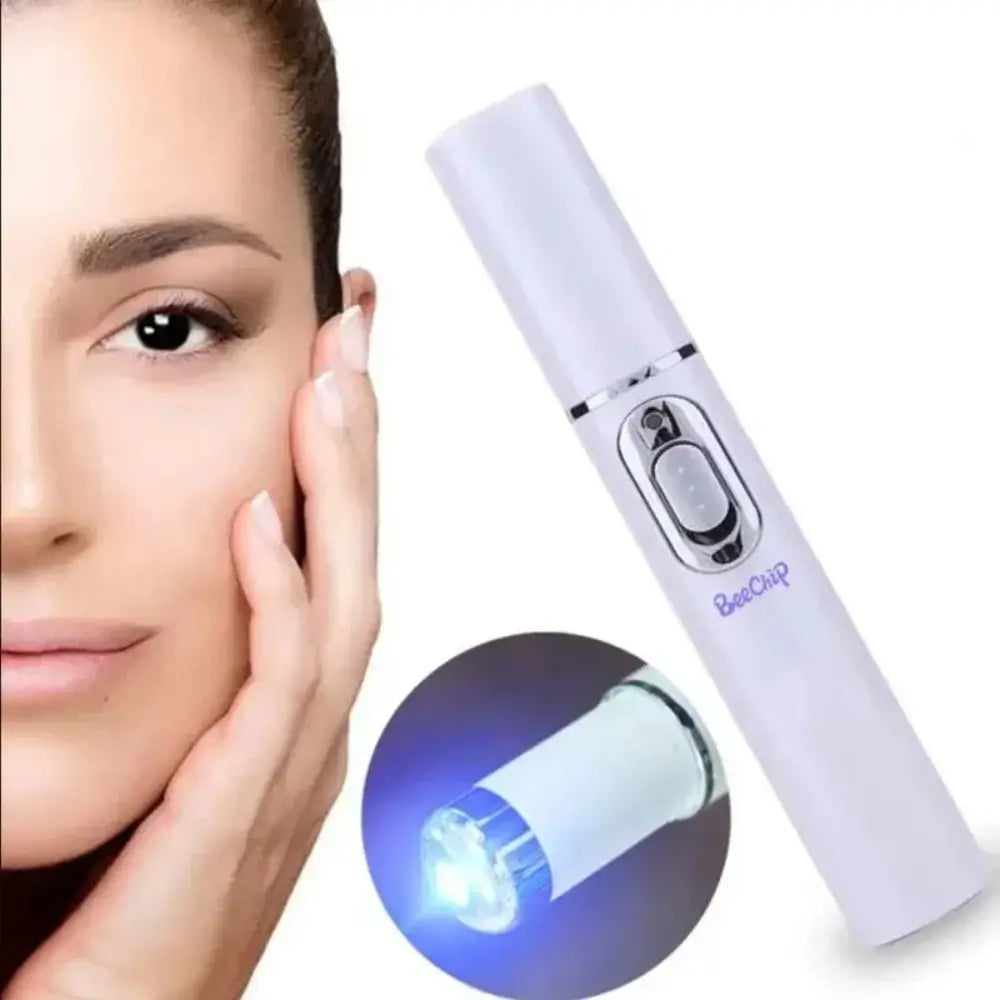 The Blue Light Therapy Facial Pen on the right with a small graphic on the head showing its blue laser. A model with her hand on her face on the left.