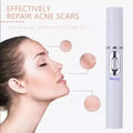 A models face on the left with little graphics of her skin showing the Blue Light Therapy Facial Pens repair on Acne scars