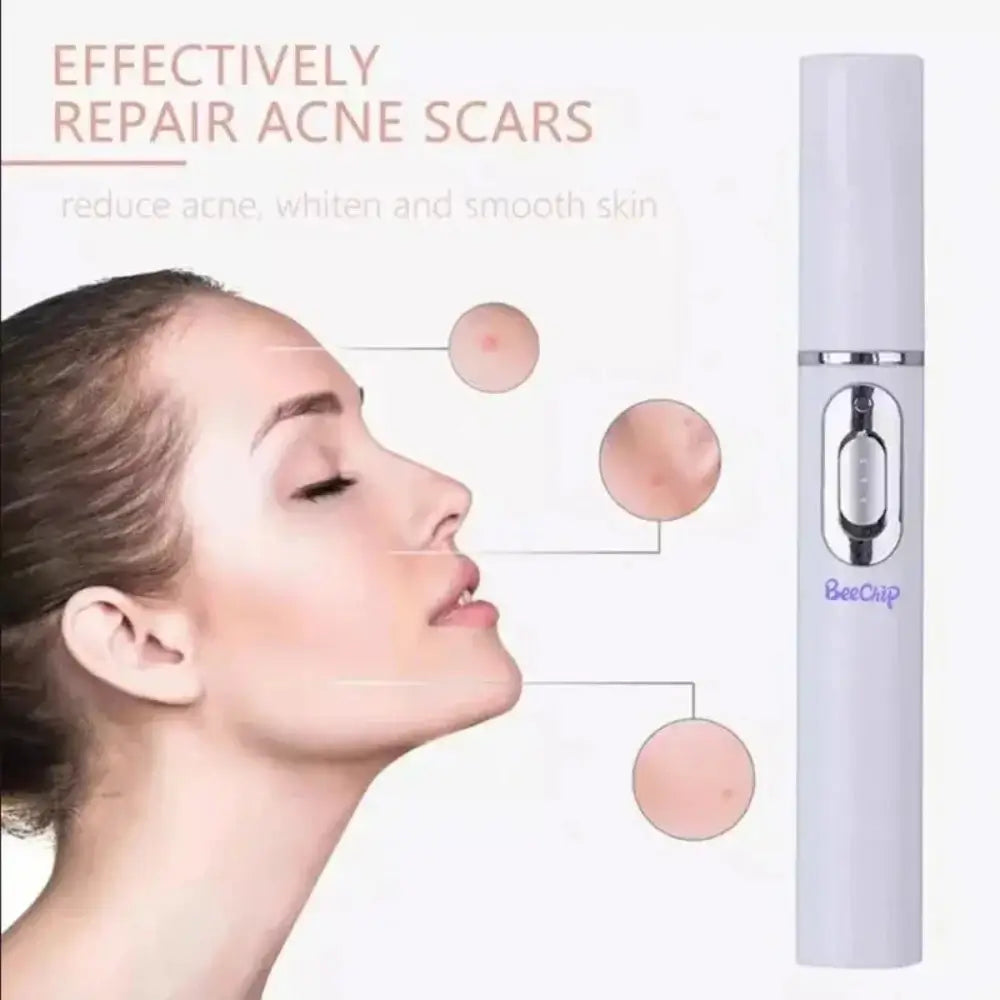 A models face on the left with little graphics of her skin showing the Blue Light Therapy Facial Pens repair on Acne scars