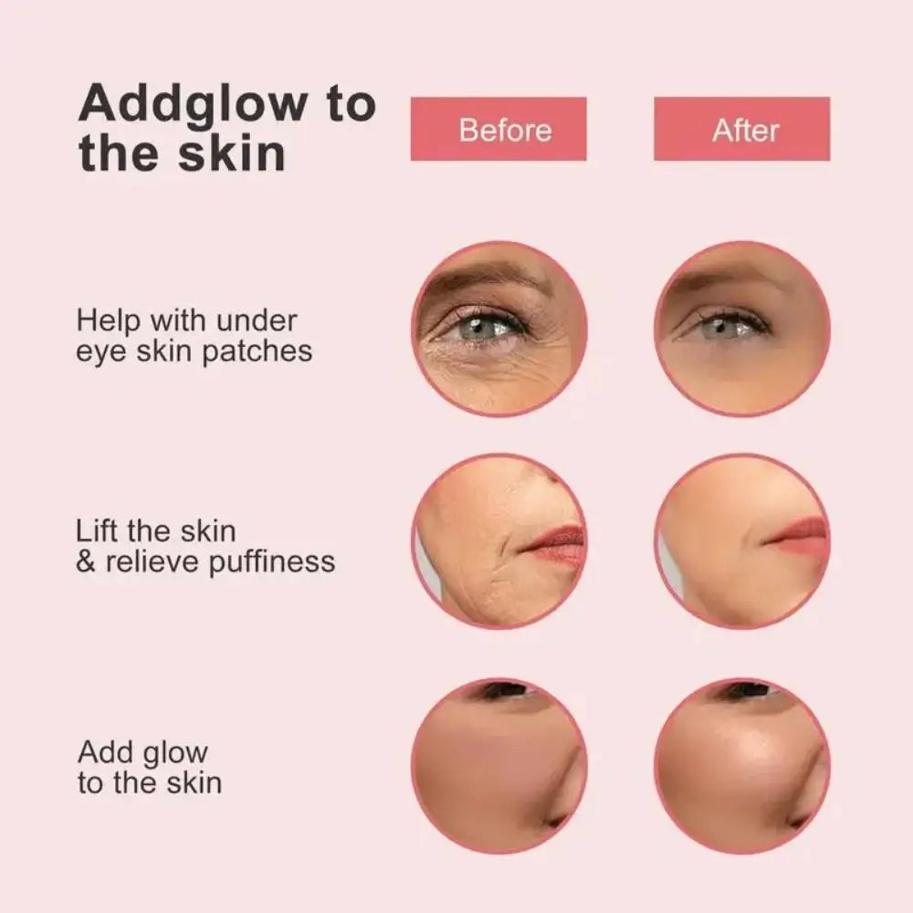 3 graphics showing before and after photos around the eyes - helps with under the eye skin patches, cheeks - lifts the skin and relieves puffiness and above the cheeks - adds glow to the skin.